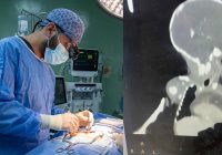 إنجاز طبي هو الأول عراقيًا.. صحة كركوك تنقذ رضيعة بعملية جراحية معقدة لحالة نادرة عالميًا