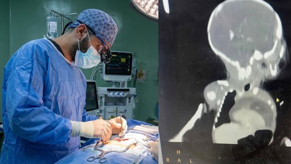 إنجاز طبي هو الأول عراقيًا.. صحة كركوك تنقذ رضيعة بعملية جراحية معقدة لحالة نادرة عالميًا