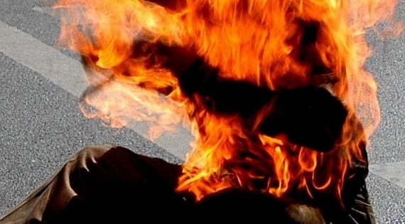 التحقيق في وفاة فتاة أنهت حياتها حرقًا داخل منزلها بمنطقة الشعلة في بغداد